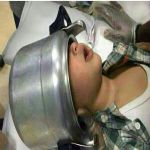 فريق طبي ينجح في اخراج راس طفل علق في قدر ضغط بالقنفذة