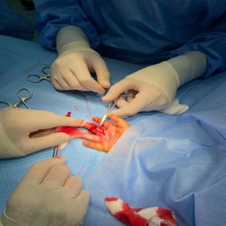 تدخل جراحي ينقذ يد رضيع تعرض لجرح عميق بمستشفى الاسياح العام