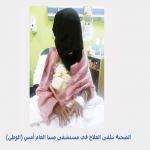 مدمن "يحرق" زوجته بصبيا