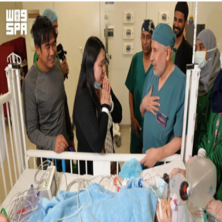 نجاح عملية فصل التوأم الفلبيني "أوليفيا وجيانا" في السعودية